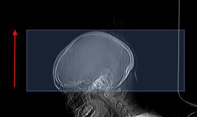 CT Protocols OHSU